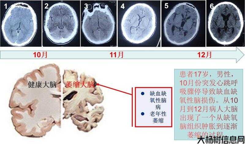 「奇迹出现」:被认定为植物人的患者终获复苏! 第2张 「奇迹出现」:被认定为植物人的患者终获复苏! 第2张
